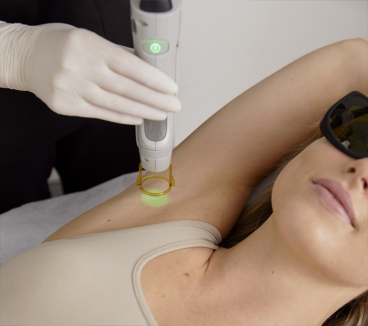 Laser Hair Removal Treatments