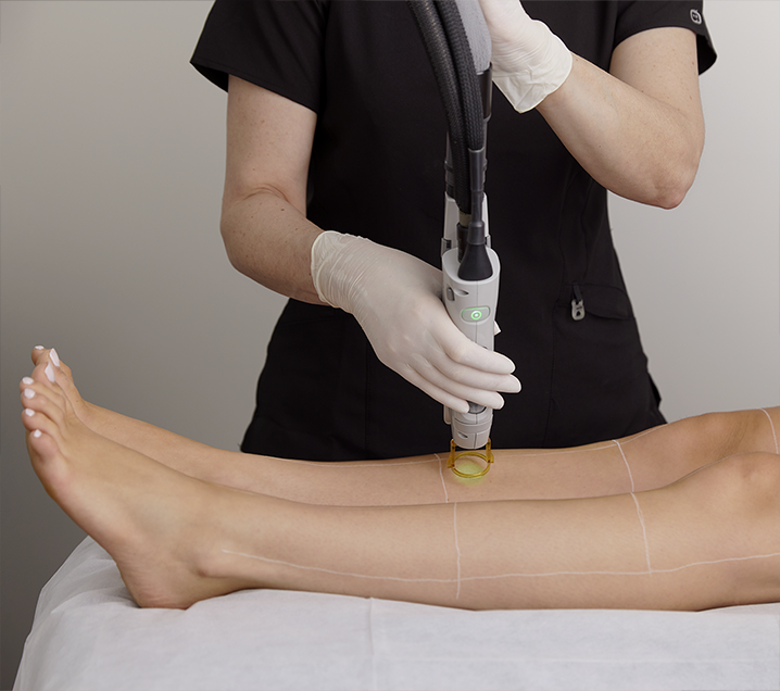 Laser Hair Removal Treatments