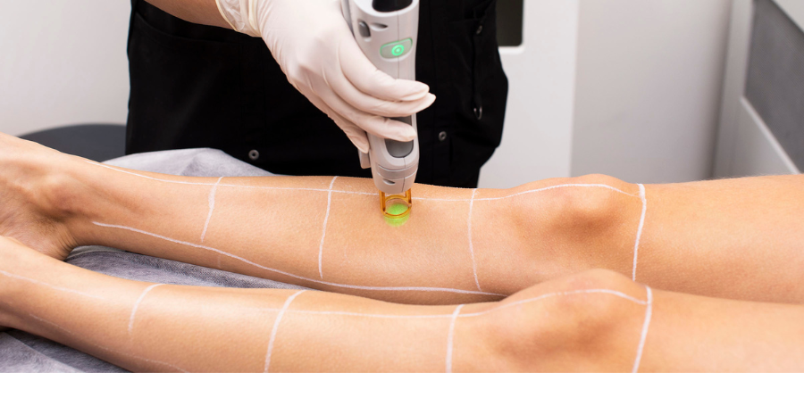 Benefits of Full Body Laser Hair Removal