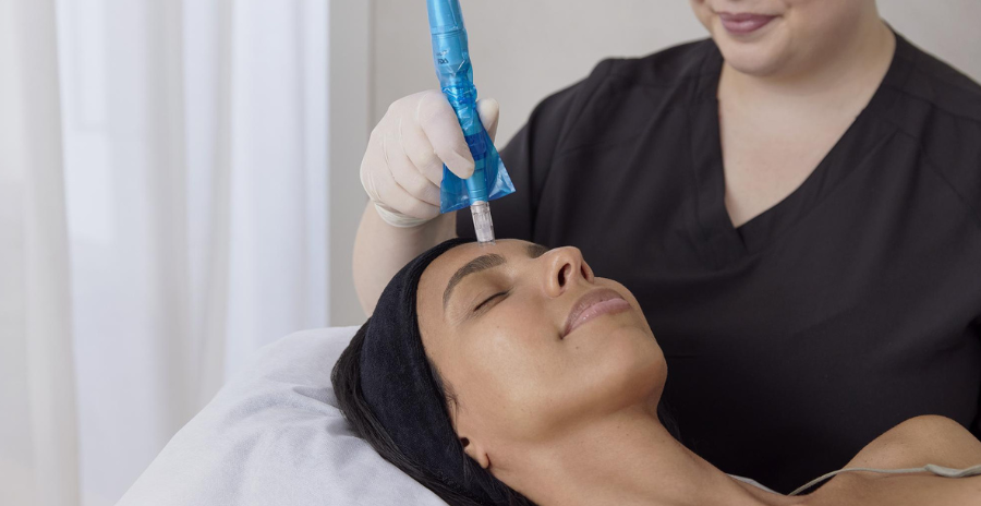 How Microneedling Works: Benefits, Aftercare, Suitability, And More