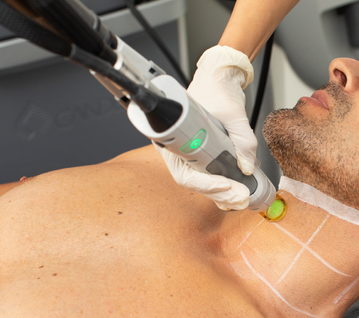 Mens Laser Hair Removal | Laser Clinics Canada