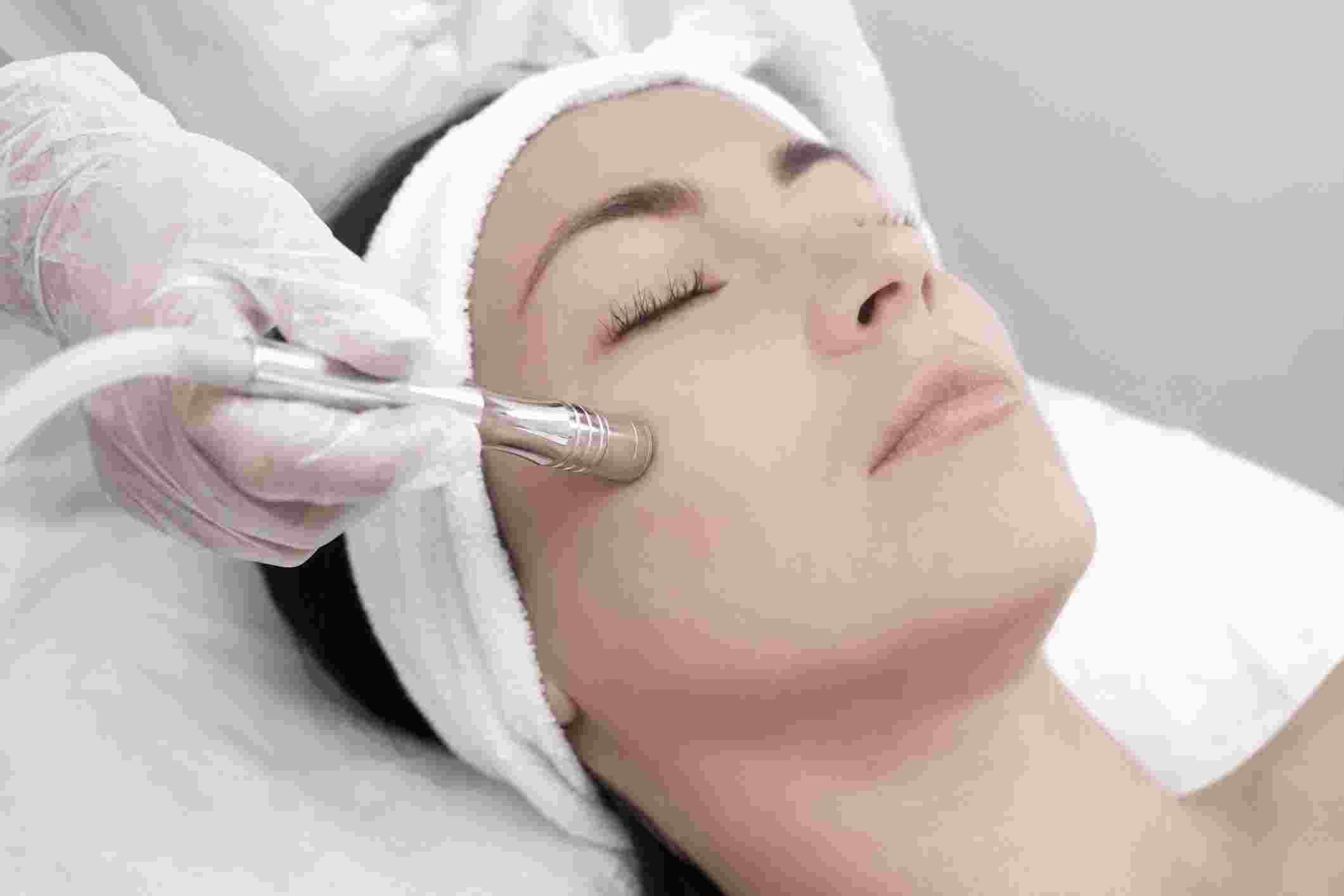 Everything you need to know about the 5-Step Microdermabrasion