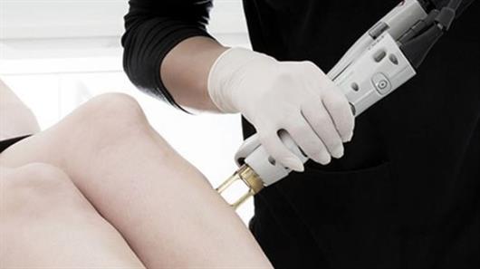 Laser hair removal center deals