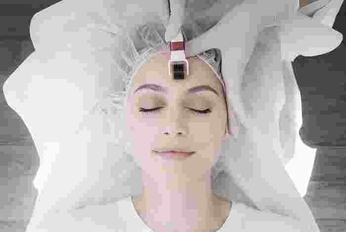 Microneedling: how to prepare for the treatment (and prices)