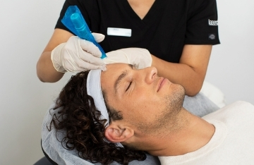 NEEDLING 230X234.jpg